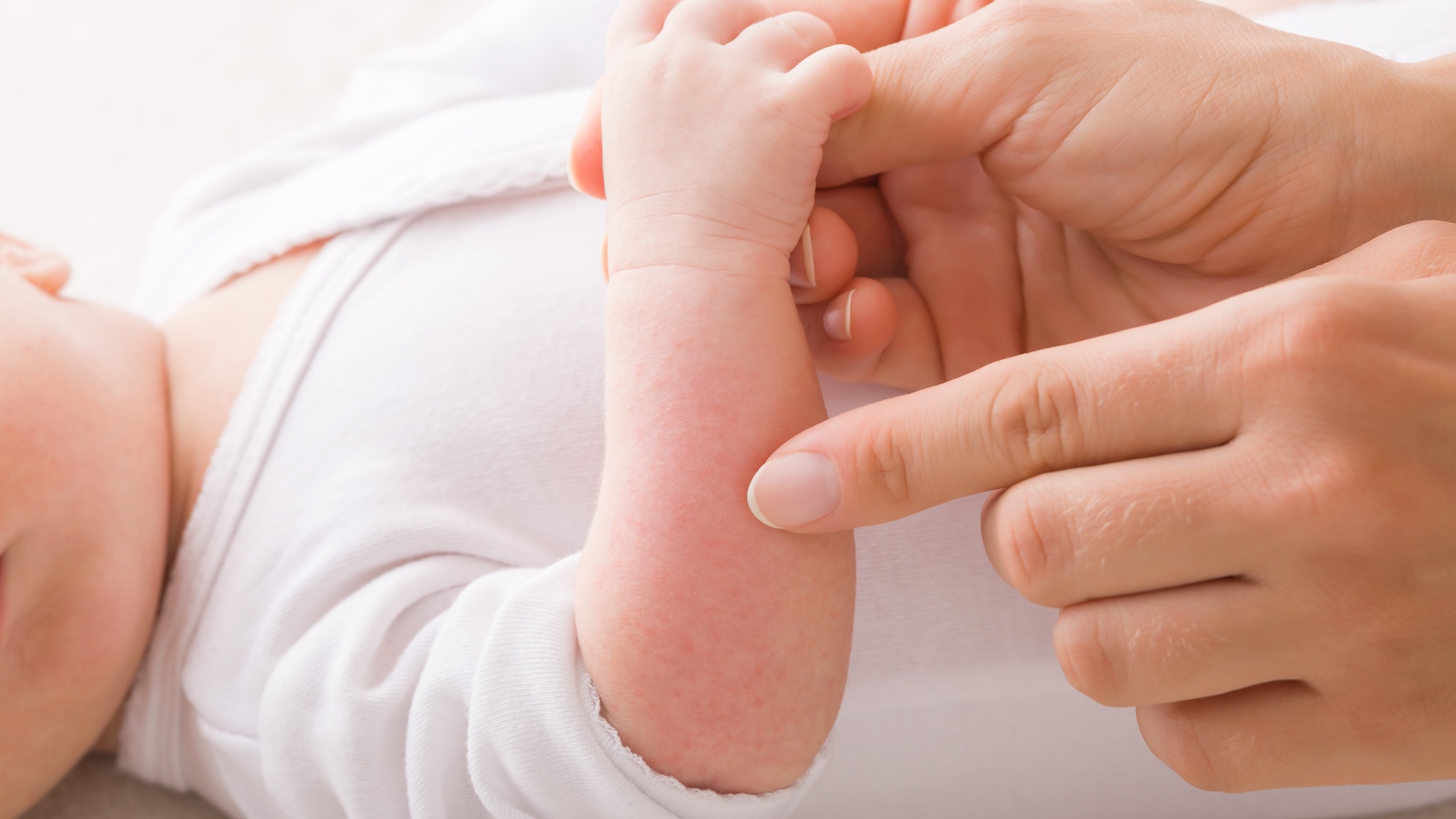 Close up of an adult holding a baby's hand with one hand and pointing to the baby's arm with the other hand, indicating a skin rash