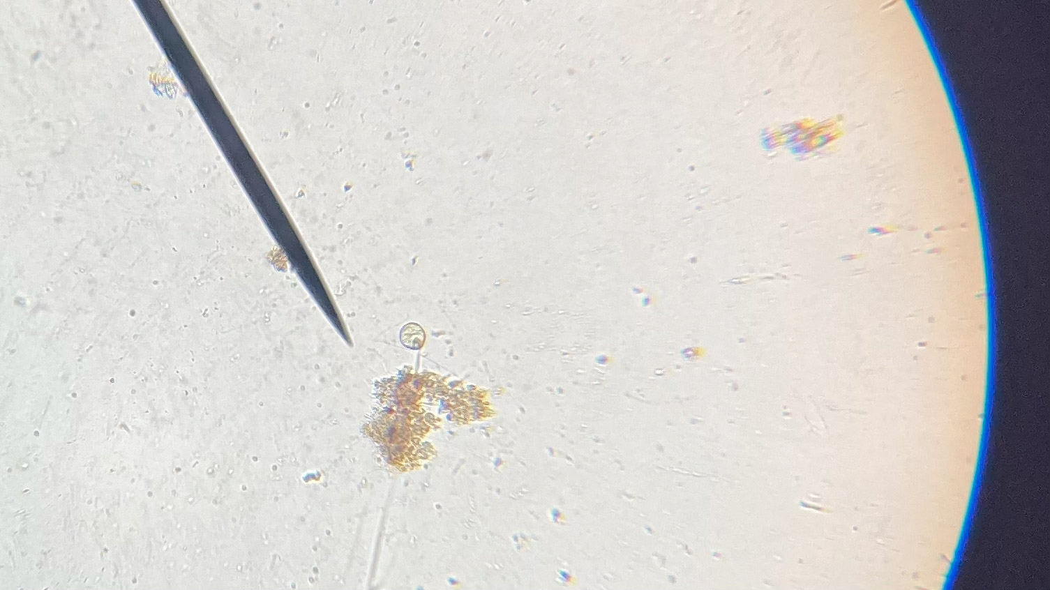 A microscopic image where the author using the pointer to show a microorganism living in pond water at 100 times magnification