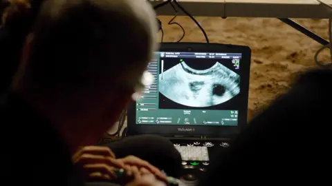 BBC/Kevin Church Ultrasound of Zanta the rhino