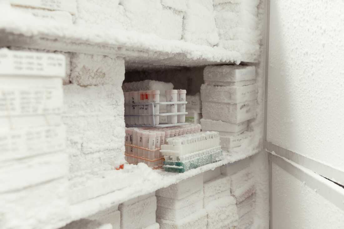 A deep freezer stocked full of biological samples from overdose cases at the toxicology lab at UCSF in San Francisco, Calif., on Friday, August 16, 2024.