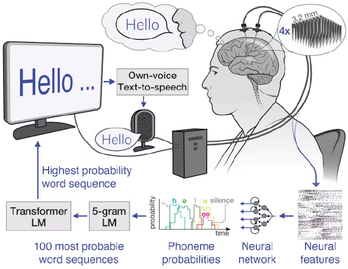 A diagram showing how the device transforms neural signals into speech through a computer, showing a series of arrows leading from the brain through a neural network and onto a computer screen