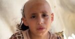 ‘Psychologically damaged,’ 8-year-old Sama loses her hair