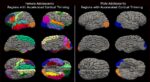 Ladies' brains aged at an 'accelerated' charge through the pandemic, research finds