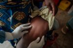 UNICEF points emergency tender to safe mpox vaccines for crisis-hit international locations in collaboration with Africa CDC, Gavi and WHO