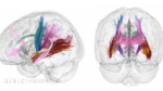 Mind adjustments throughout being pregnant revealed in detailed map