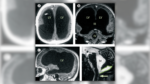 Medical Photographs Present Man with 90% of His Mind ‘Lacking’?