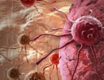 Black prostate most cancers sufferers reply higher to immunotherapy