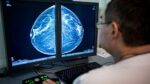 What your mammogram can let you know about your cardiovascular well being