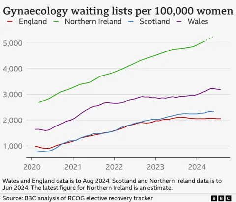 A chart showing gynaecology waits per 100,000 women. The figures are 2,055 per 100,000 in England, 2,345 per 100,000 in Scotland and 3,187 per 100,000 in Wales. Northern Ireland's figure of 5,248 per 100,000 is an estimate. 