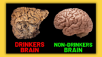 Picture Reveals Alcohol’s Impact on the Mind?