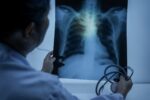 Quabodepistat combo exhibits promise for safer, sooner tuberculosis remedy